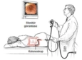 Kolonoskopi Nedir? Neden ve Nasıl Yapılır?